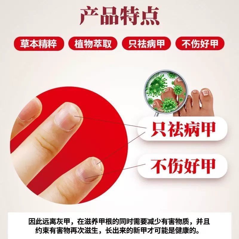 液增厚灰甲亮甲去除灰指甲专用脱甲油抑菌液一瓶[10ml]体验装>800_800