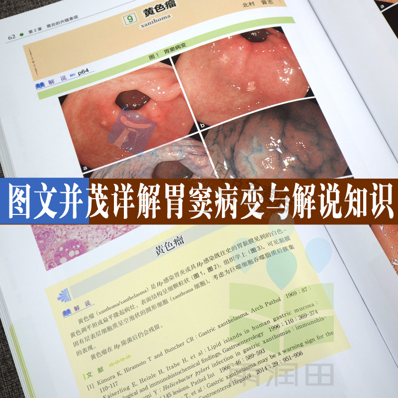 [正版]京都胃炎分类 内科手册 内科疾病诊疗指南 内科疾病鉴别诊断学 胃炎分类辅助诊断治疗 胃炎内镜诊断治疗技术 胃镜诊高清大图