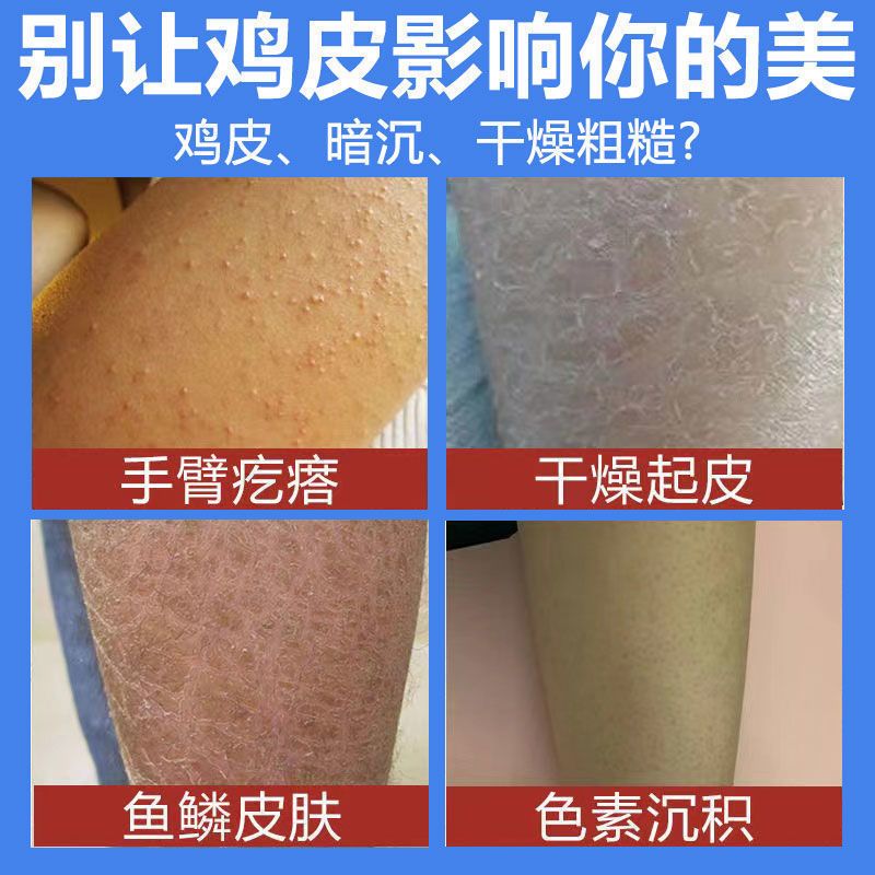 [一抹嫩]身体乳保湿补水皮肤干燥滋润持久美白香体乳去鸡皮男女 凡士林身体乳[3天美白去鸡皮] 1盒250g[滋润保湿肌肤