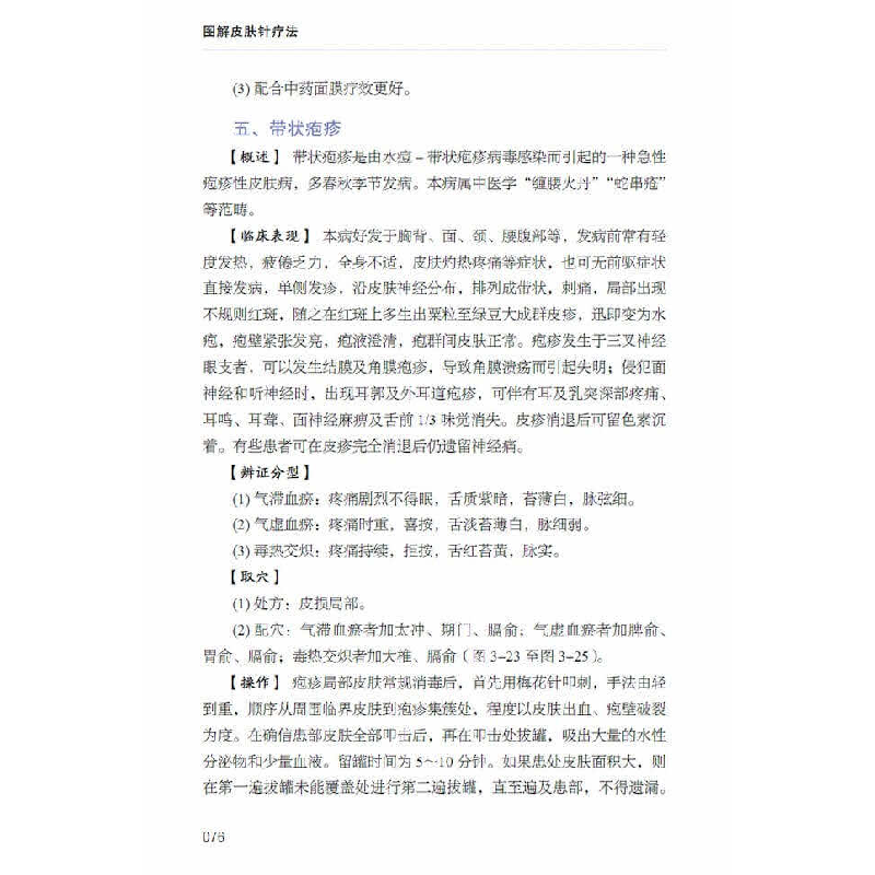 醉染图书图解皮肤针疗法978750127高清大图