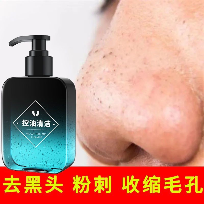 洗面奶男士专用控油祛痘除螨虫粉刺美白去黑头收缩毛孔学生青少年 [特惠]祛痘控油洗面奶1瓶
