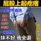 正品保证[1盒装] 屁股上有疙瘩久坐屁股痒股藓屁股疮屁股上长痘痘屁股湿疹起脓疮