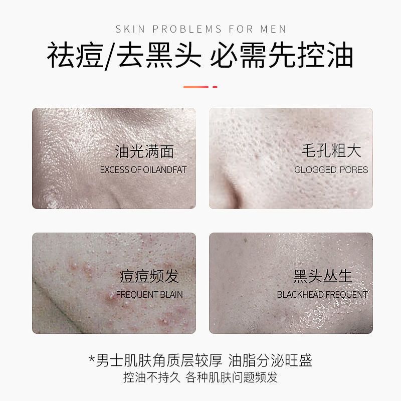 妮维雅洗面奶男士专用控油祛痘印去黑头收缩毛孔保湿洁面乳学生党 控油保湿不紧绷-壹OOg