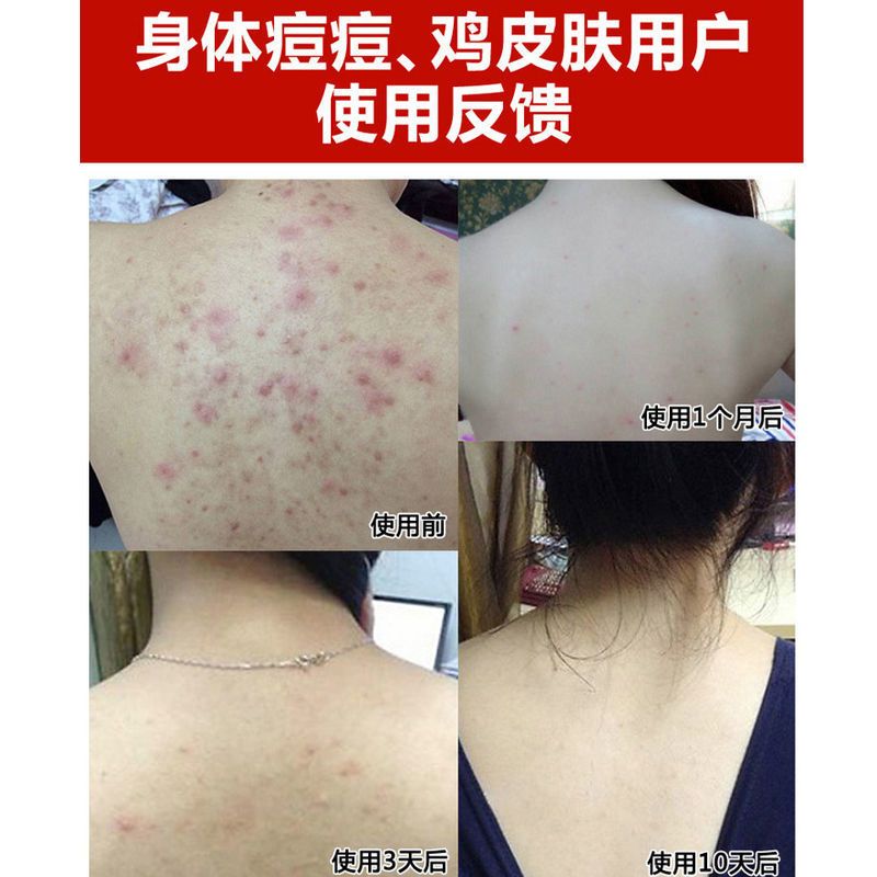 [美白祛痘体验装]1盒 除螨皂净白海盐皂洗面奶学生黑头手工皂祛痘控油羊奶洗脸香皂藏皂