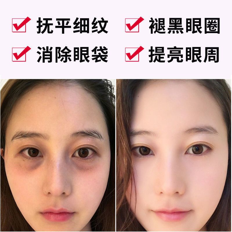 [1盒8片] 缓解眼部疲劳 燕窝酵母眼膜贴去眼袋黑眼圈祛眼袋去眼纹淡化眼细纹去皱补水眼贴