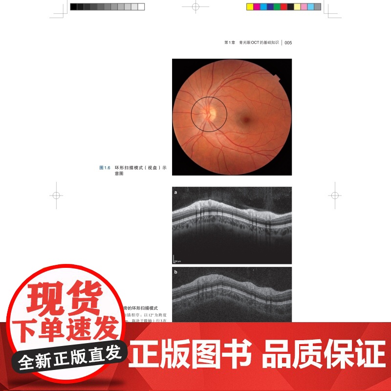 青光眼OCT图谱 相干光层析成像术OCT发展青光眼中应用基础视乳头视网膜参数戴毅主译上海科学技术出版社眼科学高清大图