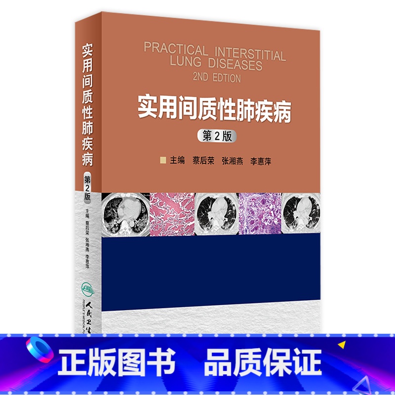 实用间质性肺疾病第2版 【正版】实用间质性肺疾病第2版 蔡后荣 张湘燕 李惠萍 主编 西医 9787117223140