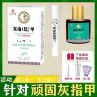 修指甲指甲穿戴甲治灰指甲亮甲灰指甲特效亮甲去除灰指甲甲沟炎 一盒装[轻度灰指甲]