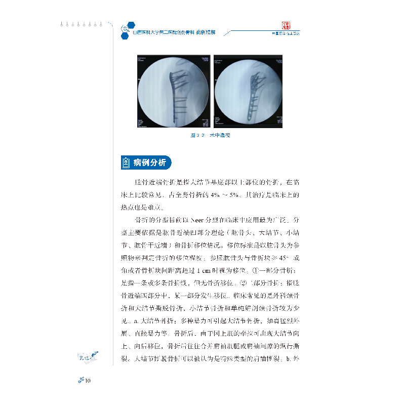 醉染图书山西医科大学第二医院创伤骨科病例精解9787518968275高清大图