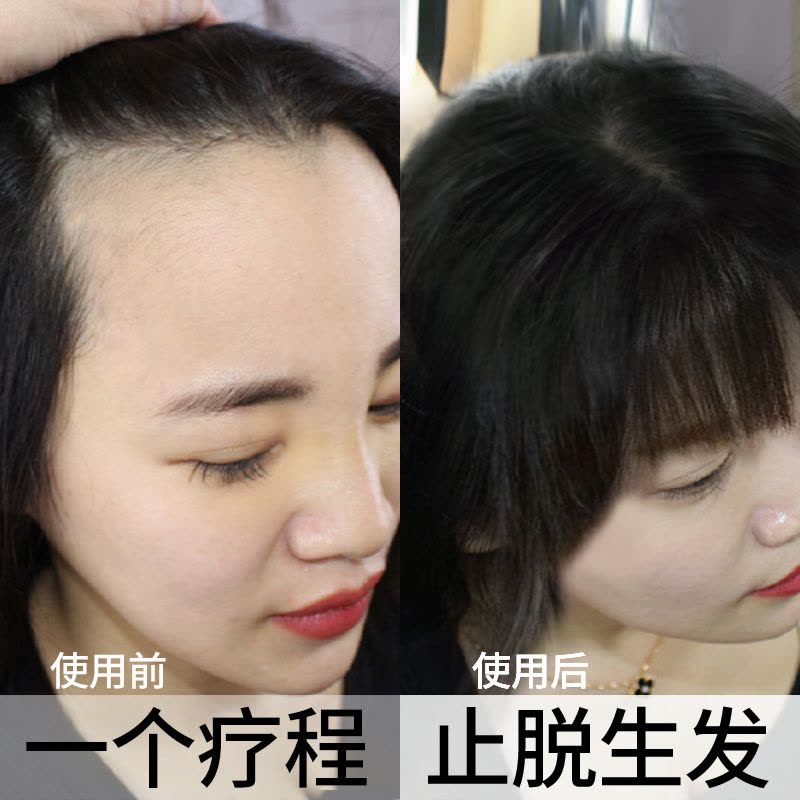 [优先发货]老姜王防脱发生发洗发水生姜汁增发密发育发膏固 重度防脱生发套餐400ml*3+20ml*3 其他/other图片