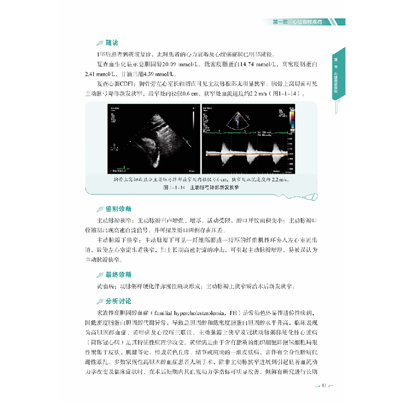 醉染图书心血管超声疑难病例解析9787518999071高清大图