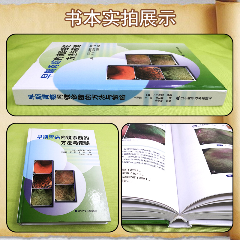 [正版] 早期胃癌内镜诊断的方法与策略 主编日小山恒男 消化疾病临床案例诊治教程 肿瘤医学参考书 辽宁科学技术出版社97