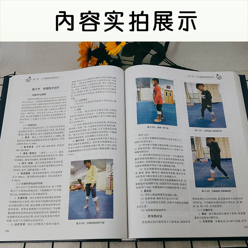 [正版] 实用小儿脑性瘫痪康复治疗技术第2版 第二版 李晓捷 实用儿童康复医学参考工具书籍 人民卫生出版社 97871高清大图