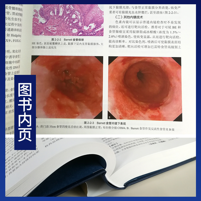 [正版]询单优惠消化病学实用消化道内科学书籍内镜系统疾病高级教程胃肠镜诊断图谱京都胃炎分类病理参考书陈旻湖杨云生唐承高清大图