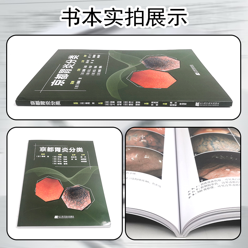 [书]京都胃炎分类 吴永友,李锐主译 消化内科学临床案例诊治教程胃炎内镜诊断技术胃肠疾病参考工具书籍 [正版]书京都胃炎高清大图