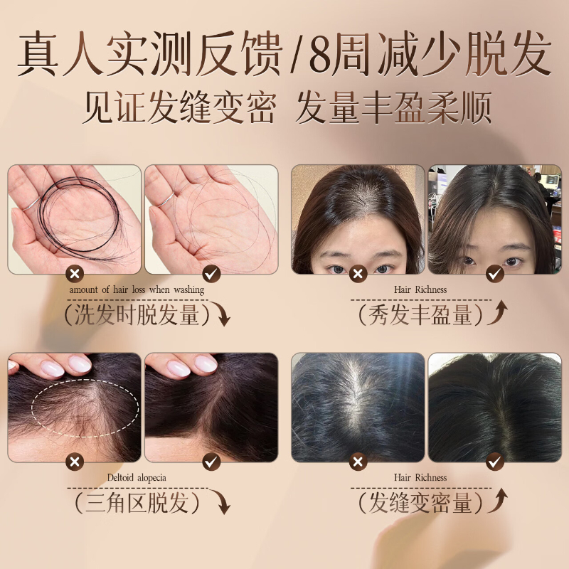 三个魔发匠 防脱精华洗发乳 凹凸姜字方瓶 500ml*2高清大图