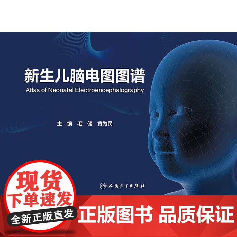 新生儿脑电图图谱高清大图
