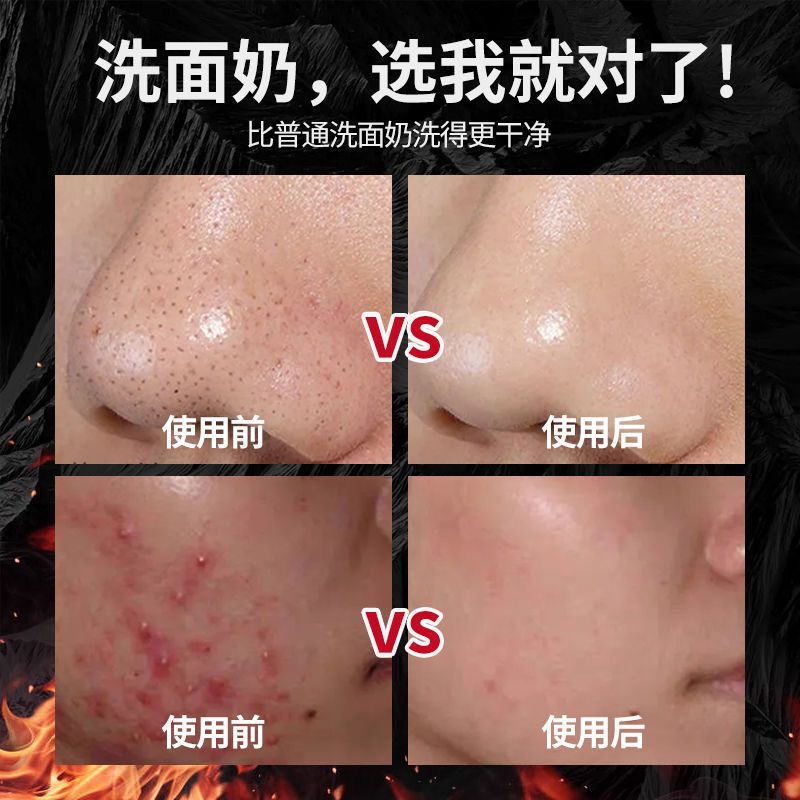 欧莱雅男士洗面奶男控油祛痘印去黑头除螨虫收缩毛孔洁面乳膏学生 []抗黑头50g+火山岩50g