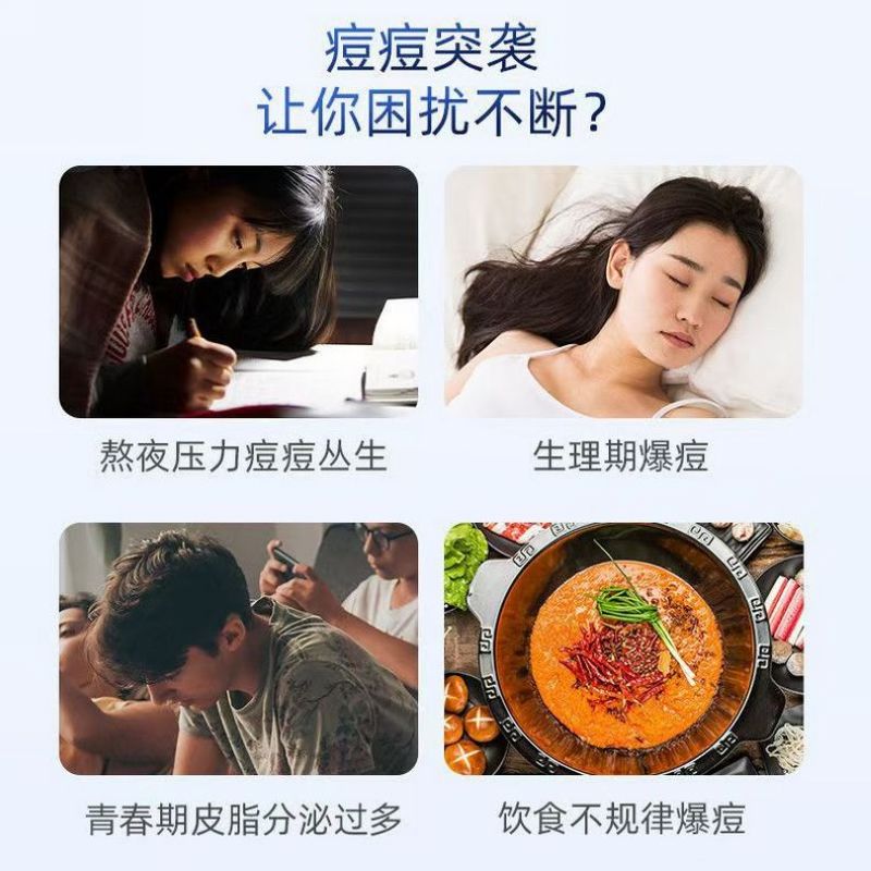 海氏海诺 36贴装日夜两用水胶体型创可贴物理消痘隐藏痘印痘创轻薄亲肤痘痘贴高清大图