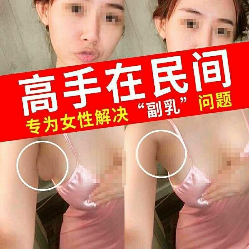 副乳贴淋巴结肿大炎贴颈部腋下排毒腹股沟硬块淋巴散结膏