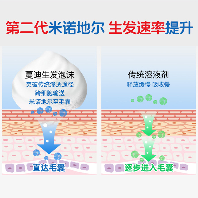 蔓迪 米诺地尔泡沫剂 60g*3瓶 二代生发泡沫酊男士曼迪官方旗舰店正品高清大图