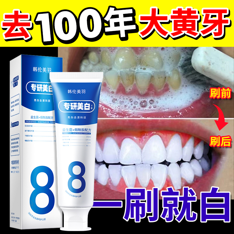 美白牙膏去黄速效洗白牙齿去除黄牙结石器溶解牙石去口臭男士专用