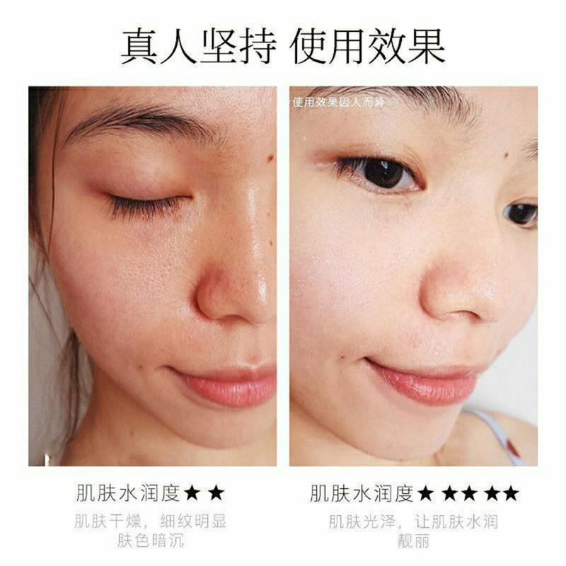 [水乳两件套]护肤品套装学生女控油爽肤水补水乳液|[爽肤水190
