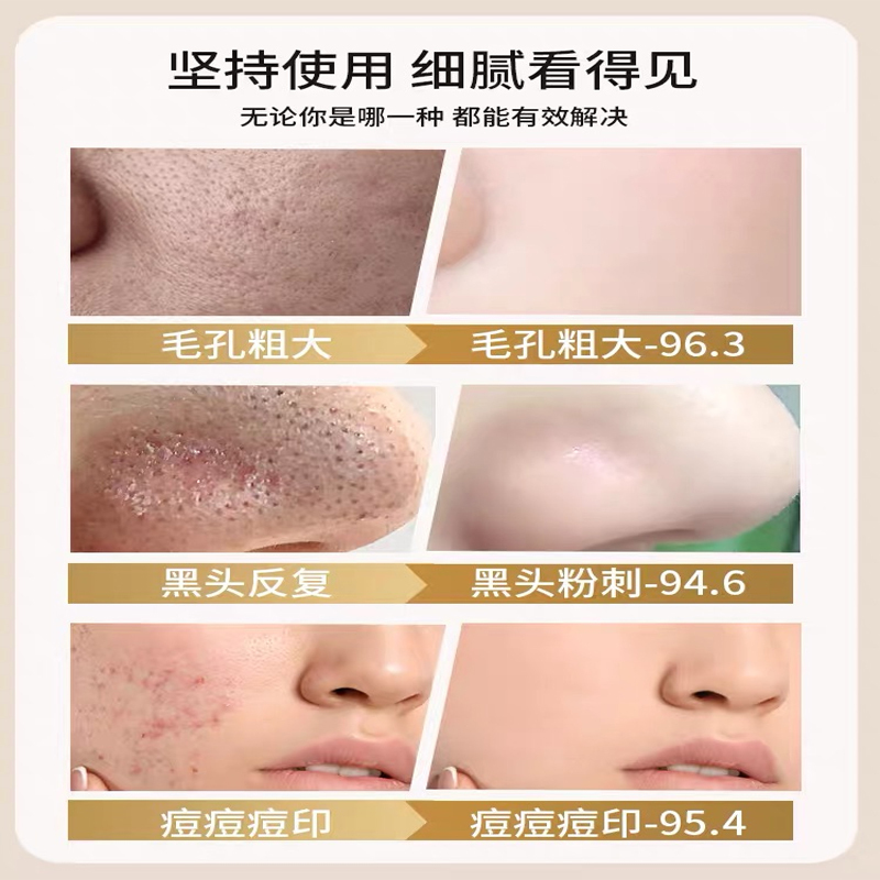 可可丽人乳糖酸精华液修复粗大收缩毛孔收敛水杨酸非刷酸祛痘印去闭口粉刺