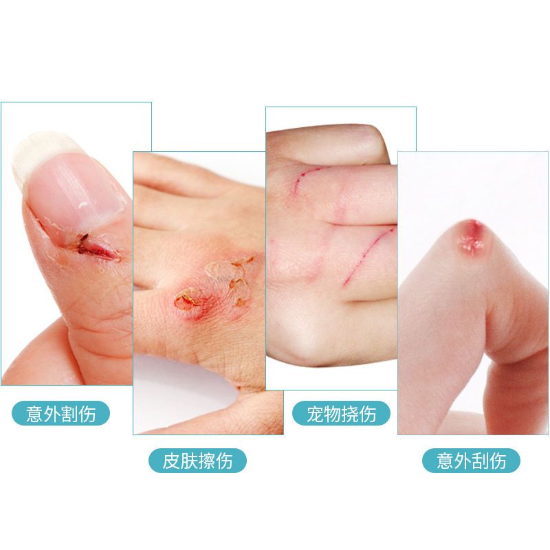 海氏海诺液体创可贴透明防水液体敷料护创保护膜磨脚后跟 液体敷料