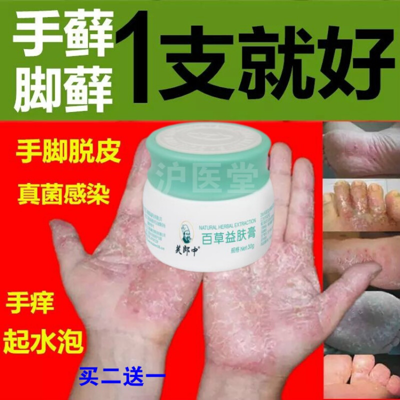 鹅掌风手癣膏手足癣真菌感染水泡手痒脱皮干裂止痒手气膏鹅掌风膏参数