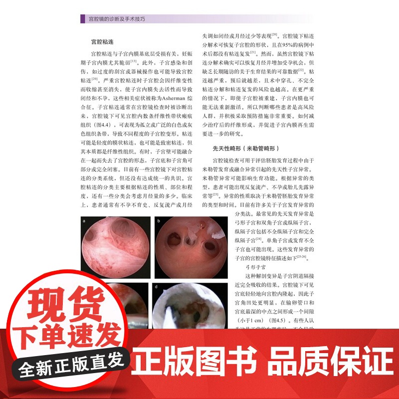 宫腔镜的诊断及手术技巧 子宫疾病 内窥镜检 妇科外科手术 北京科学技术高清大图