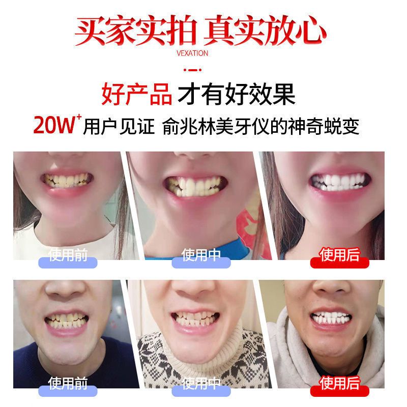 碧缇福美牙仪洗牙神器牙齿美白神器去黑黄烟渍洁牙神器美女牙凝胶 一支凝胶