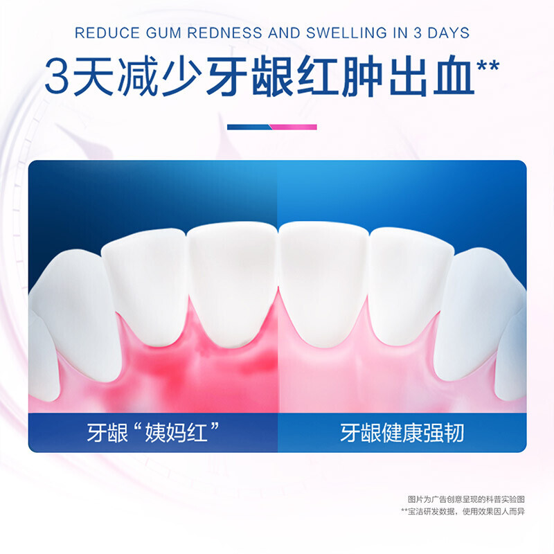 Oralb欧乐B氨基酸牙膏减少牙龈红肿清新口气含氟男士女士-对抗红肿140g*1支高清大图