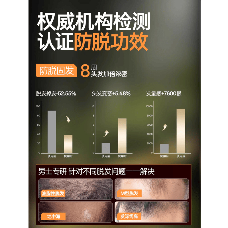 左颜右色防脱洗发露300ml高清大图