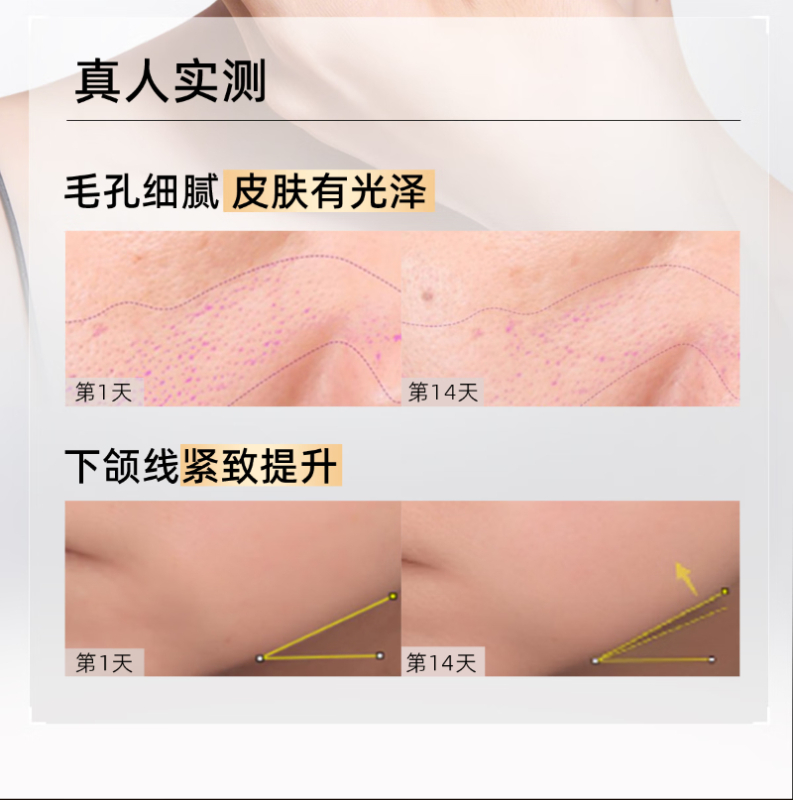 C咖 清透面霜精华组合 BJDT高清大图