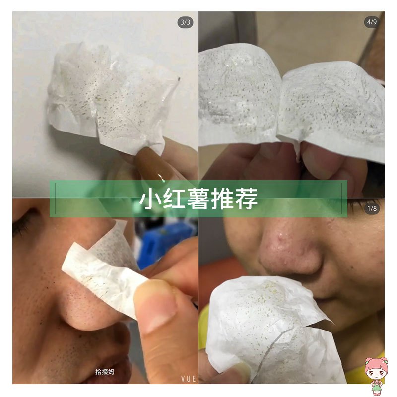 柏翠丝茶树去黑头收缩毛孔清洁吸鼻贴撕拉面膜套装神器导出液女男