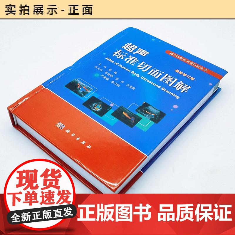 超声标准切面图解(修订版) 科学出版社 9787030590220高清大图