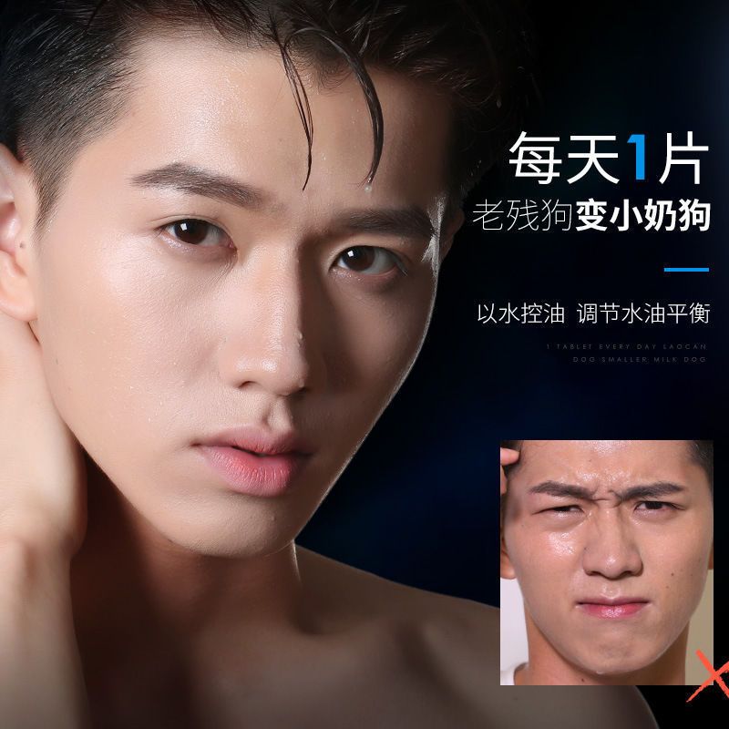 [40片19.9]男士面膜补水控油保湿祛痘去黑头收缩毛孔亮肤学生男 [盒装]面膜10片