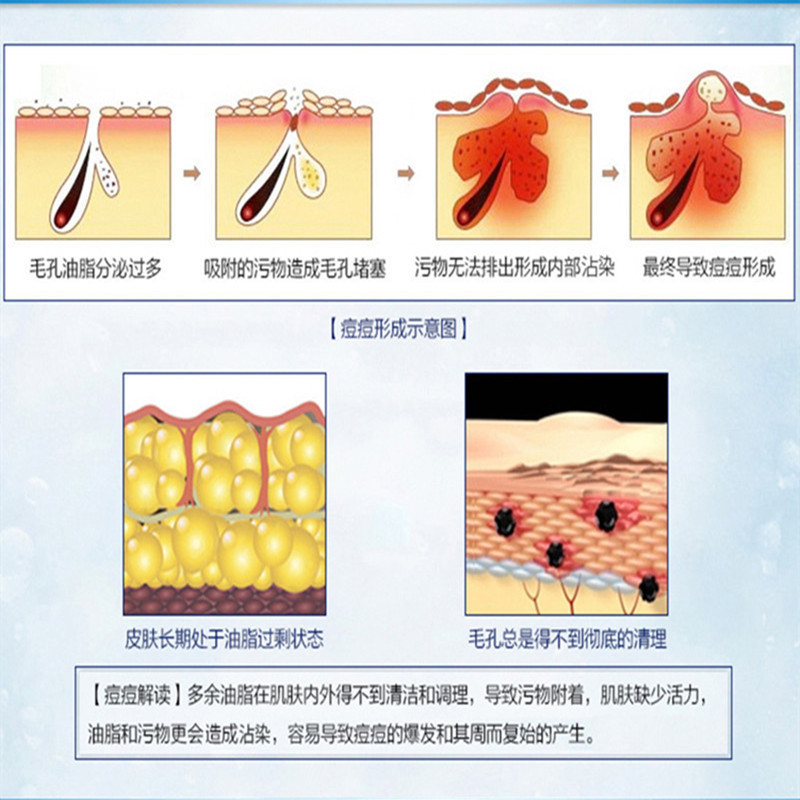 (2件5折)片仔癀清痘洁肤乳100ml女士男士洁面乳洗面奶深层清洁(改善青春痘/粉刺痘印)清爽补水保湿护肤品正品q