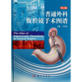 普通外科腹腔镜手术图谱(第2版)