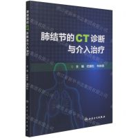 肺结节的CT诊断与介入治疗