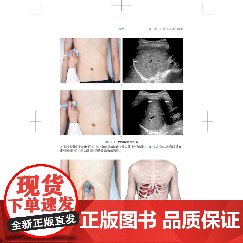 消化系统疾病超声入门 医生文字简练大量影像图手绘图直观易懂超声专业研究生规培学员教程临床医师参考书 上海科学技术出版社高清大图