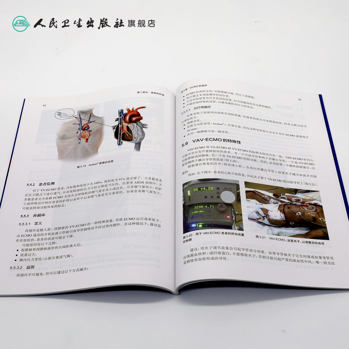 [正版]体外膜肺氧合监测和护理尚游黄海燕体外反搏心力衰竭呼吸与危重症医学ECMO呼吸内科学内科护理人民卫生出版社内科学高清大图