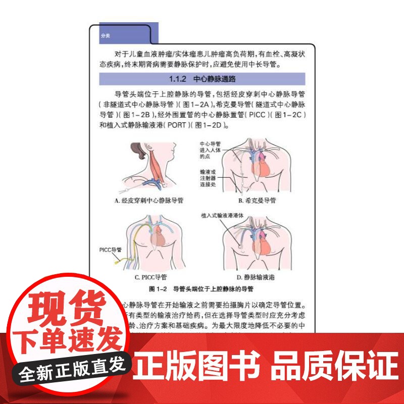 儿童血管通路管理高清大图