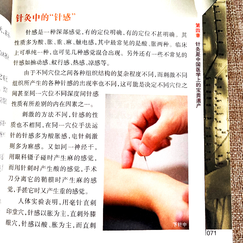 吴雅楠编著针灸是针法和灸法的合称中医学的重要组成部分中国>800_800