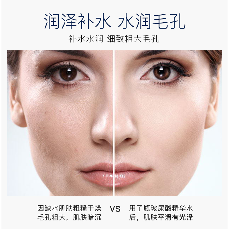 形象美玻尿酸润泽精华爽肤水500ml保湿补水爽肤水高清大图