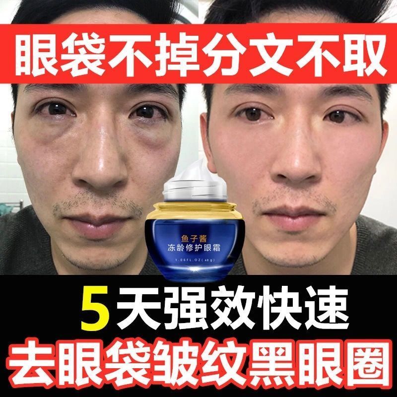 眼霜去眼袋皱纹黑眼圈脂肪粒鱼子酱祛鱼尾法令抬头纹40g 鱼子酱1瓶装[假一赔十]