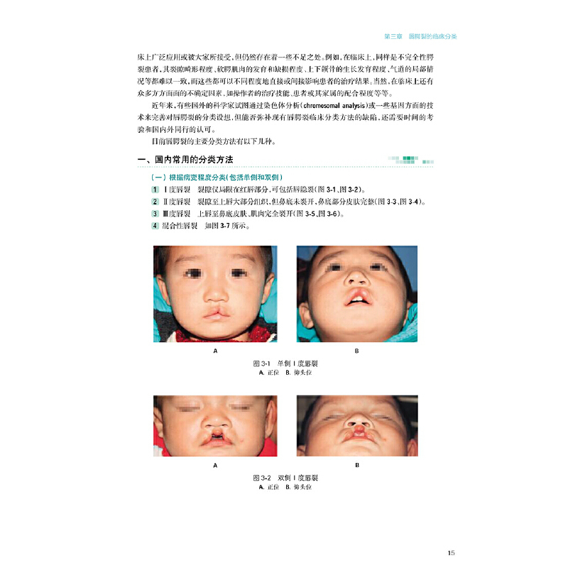 [正版]书籍美容外科学全书——唇腭裂序列治疗学