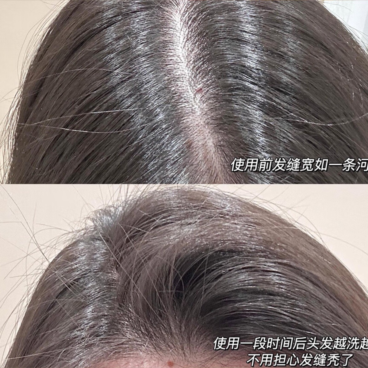 滋源-535ml生姜强根健发防脱洗头水(油性)高清大图