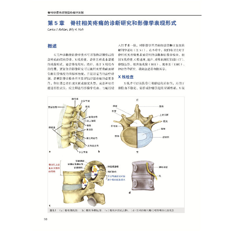 正版新书]脊柱硬膜外腔镜操作规程图解(美)丹尼尔·H.金(Daniel高清大图
